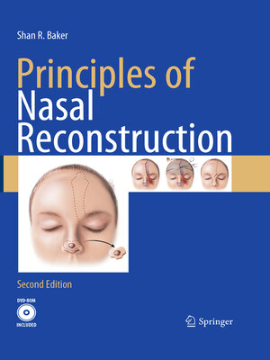 cover image of Principles of Nasal Reconstruction